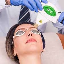 IPL PhotofacIal with Microinfusion Facial Treatment