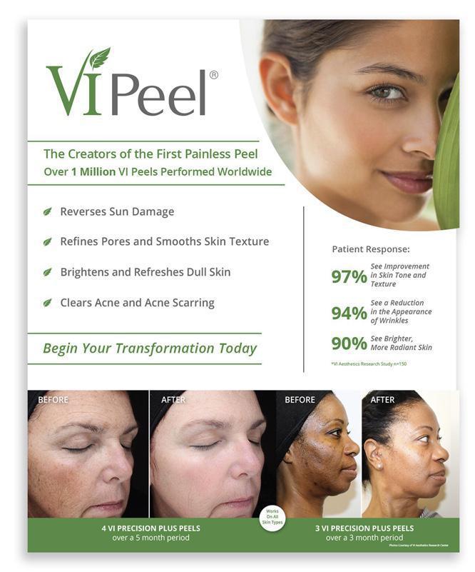 VI Advanced Peel